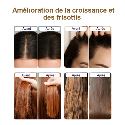 ⚜️ Appareil de Massage Cuir Chevelu & Applicateur de Sérum – Stimulateur de Repousse des Cheveux.
